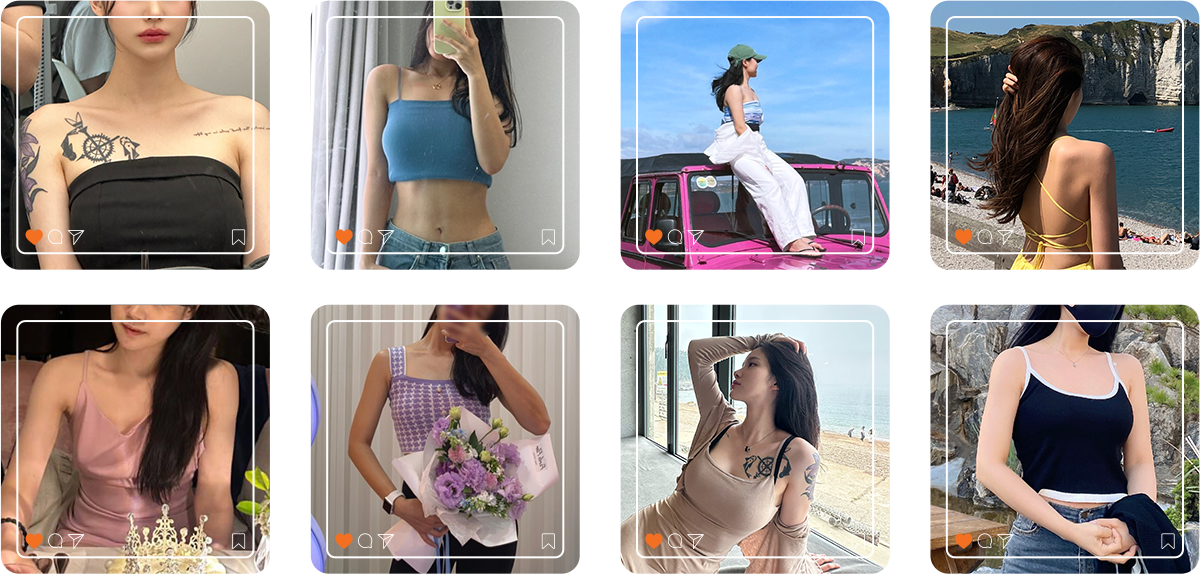 Arm liposuction before and after results - 365mc patients