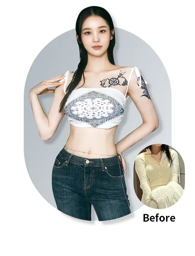 Liposucción de brazos 2.0 Edición hombro en ángulo recto result - 365mc