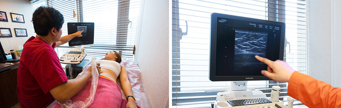 Análisis de la Capa de Grasa